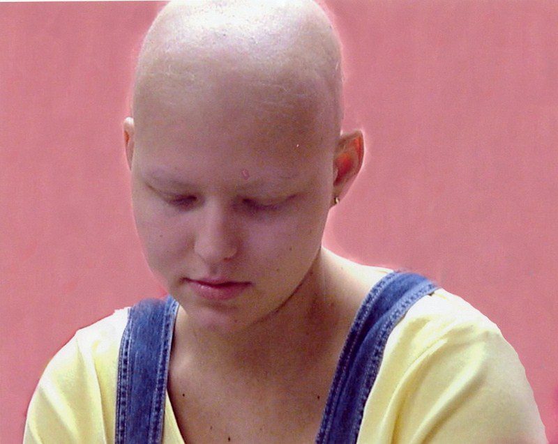 A bald woman with a yellow shirt and blue jeans